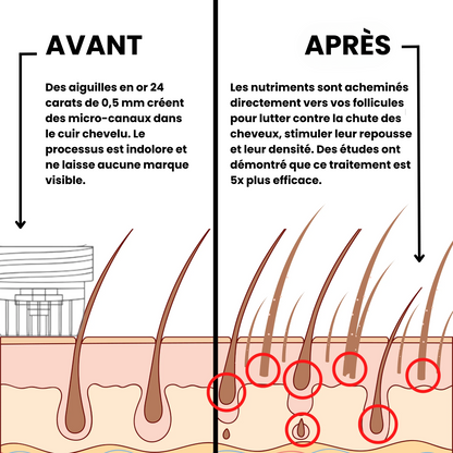 Leralia™ Système de Repousse Capillaire